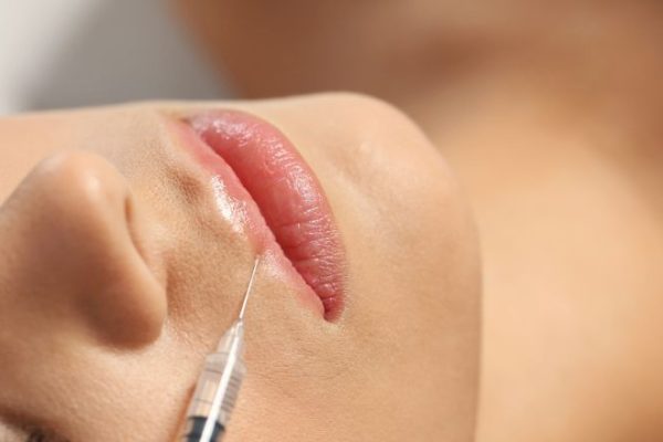 Lifting Labbra Roma: Tecniche, Risultati e Tempi di Recupero