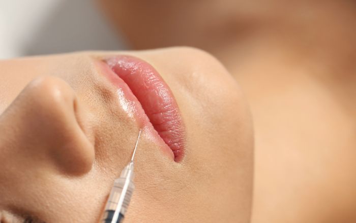 Lifting Labbra Roma: Tecniche, Risultati e Tempi di Recupero
